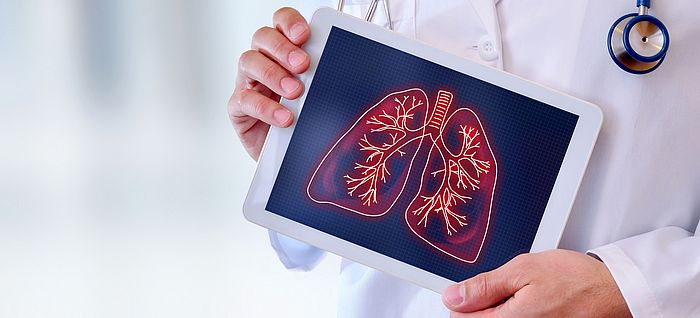 Ein Arzt hält ein iPad in die Kamera auf dem das Bild einer Lunge angezeigt wird