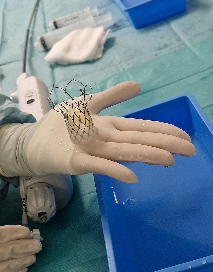 Deutschlandpremiere an den SHG-Kliniken Völklingen: Spezielles TAVI-System erstmals erfolgreich eingesetzt Die TAVI-Herzklappe unmittelbar vor der Implantation.